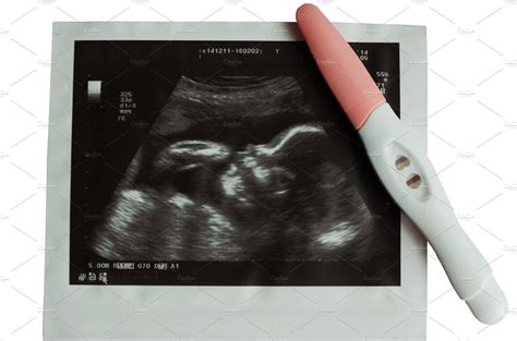 Ultrasound picture of baby with pregnancy test containing photo ...