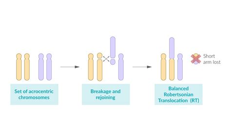 Translocation Down Syndrome Karyotype