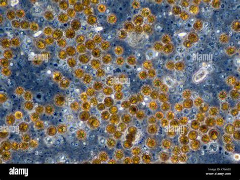 Microscopic photo of symbiotic algae (Zooxanthellae) of the dinoflagellat genus Symbiodinium ...