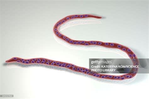 Onchocerca Volvulus Parasitic Worm Illustration High-Res Vector Graphic - Getty Images