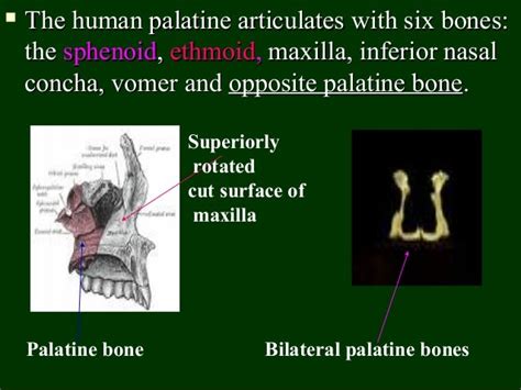 Palatine bone