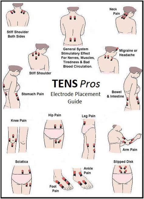 18 best muscle stimulator placement images on Pinterest | Physical ...