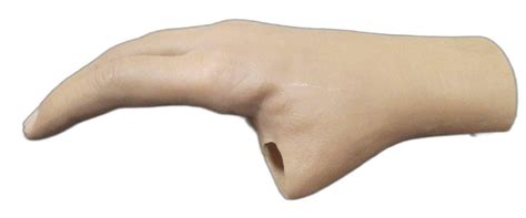 Silicone Partial Hand Prosthesis, Myoelectric at Rs 70000 in Chandigarh