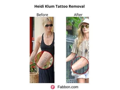 25 Celebritities Who Removed Their Tattoos | Fabbon