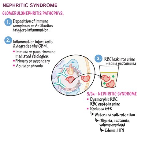 Pathology Glossary: Nephritic Syndrome & Glomerulonephritis | Draw It to Know It