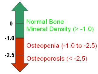 What do I do with my Brittle Bone?