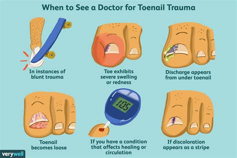 Hematoma Toenail