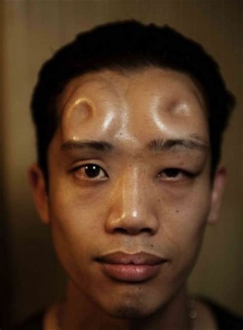 12 "Bagel Head" Transformations | Body modifications, Weird fashion trending, Facial implant