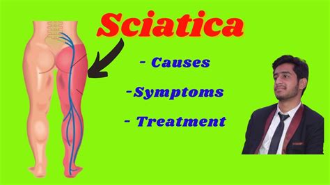 Sciatica - causes, symptoms, treatment, L4-L5, L5 -S1 disc prolapse ...