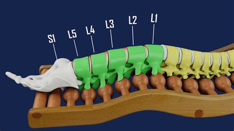 Lumbar Spinal Joint Dysfunction Syndrome - Spinal Backrack