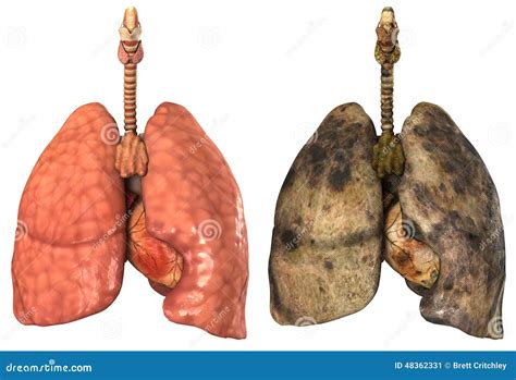 Lungs Of A Smoker Stock Illustration - Image: 48362331