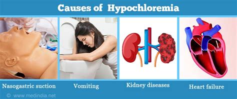 Hipocloremia: Causas, Síntomas, Diagnóstico, Tratamiento y Prevención ...