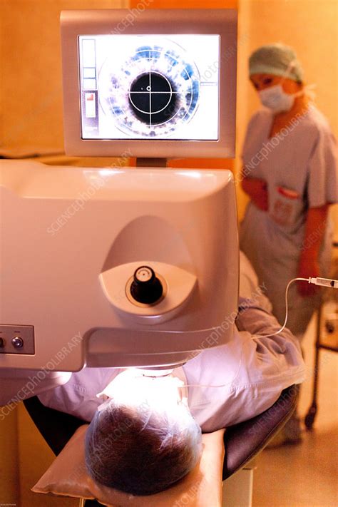 Myopia surgery - Stock Image - C032/9635 - Science Photo Library