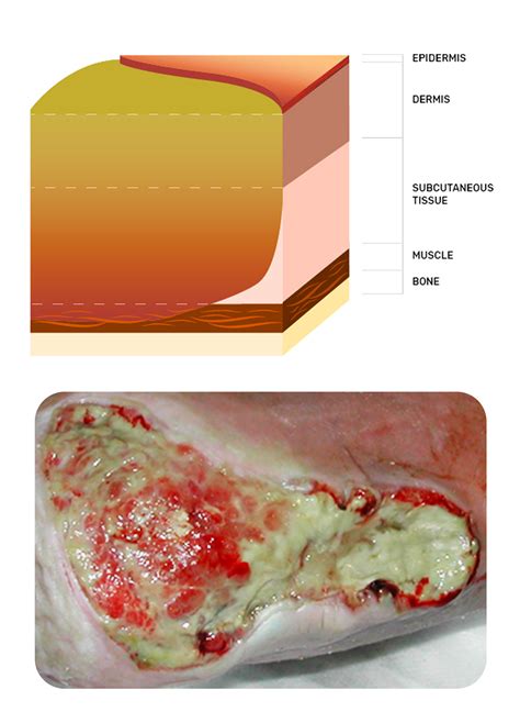 Wound Care: A Guide to Practice for Healthcare Professionals (2022)