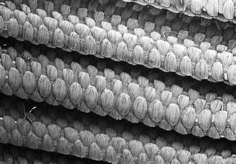 SEM of woven dacron graft material | Wellcome Collection