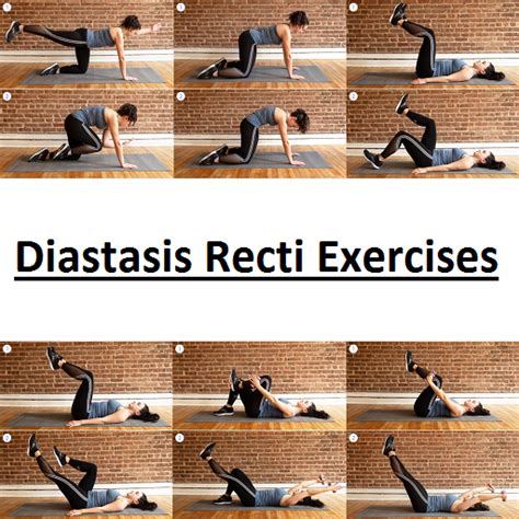 Diastasis Recti Exercises for PC / Mac / Windows 11,10,8,7 - Free ...