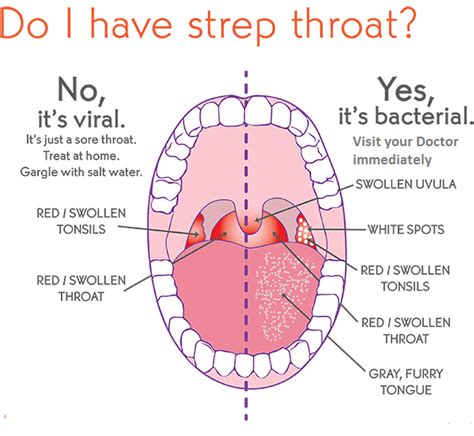 Sign in | Throat remedies, Strep throat remedies, Strep throat