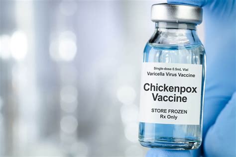 Chickenpox and its Vaccine for Babies - Being The Parent