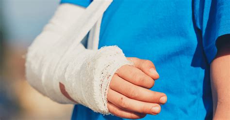 Learn more about the recovery timeline from hand surgery.