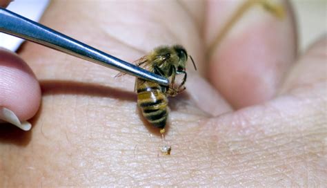 Bee Sting Therapy Has Proven Helpful In Treating Several Diseases - Small Joys