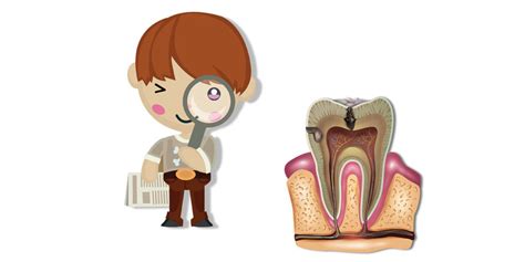 Root Canal Complications You Need To Watch Out For - dentistryed2019