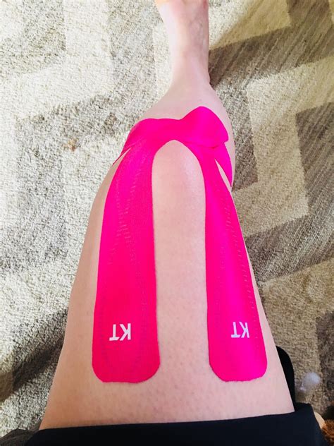 KT Tape for knee support : r/ehlersdanlos