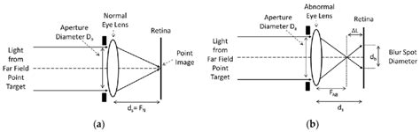 (a) Optical ray diagrams for an eye lens system having a normal eye... | Download Scientific Diagram