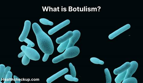 Botulism - Definition, Symptoms, Diagnosis, Treatment