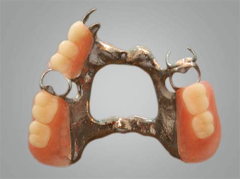 Dentures - a comprehensive guide for patients in Oakville - Bronte Road ...