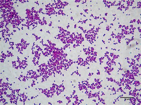 Microbiología e Higiene Alimentaria: febrero 2017