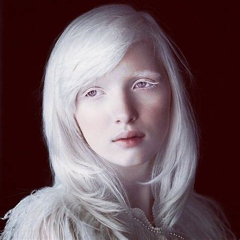 The Most Beautiful Albino Girl in the World, Nastya Zhidkova, was born ...