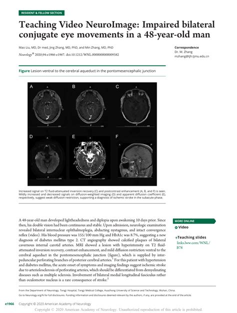 (PDF) Teaching Video NeuroImage: Impaired bilateral conjugate eye ...