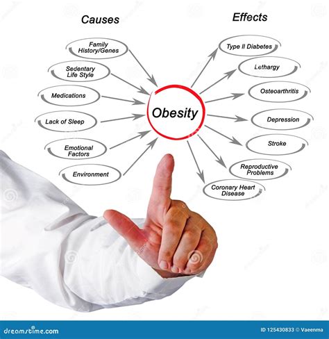 Obesidad: causas y efectos imagen de archivo. Imagen de conferenciante ...