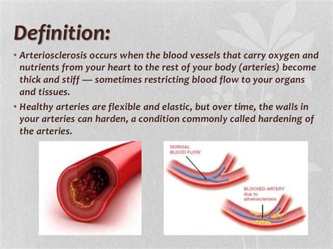 Atherosclerosis