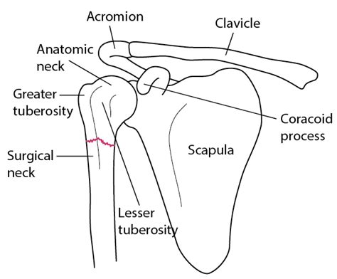 Proximal Humeral Fractures - Injuries; Poisoning - MSD Manual Professional Edition