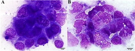 Conventional cytology results: positive IFCCs (A) and cytolysis after... | Download Scientific ...