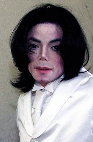 Michael Jackson Nose Collapse