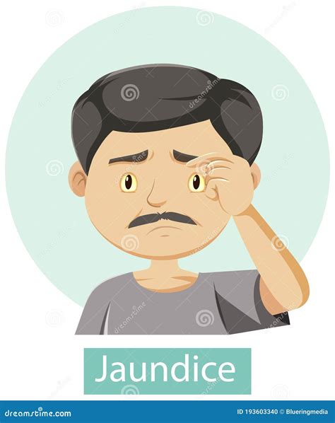 Cartoon Character with Jaundice Symptoms Stock Vector - Illustration of ...