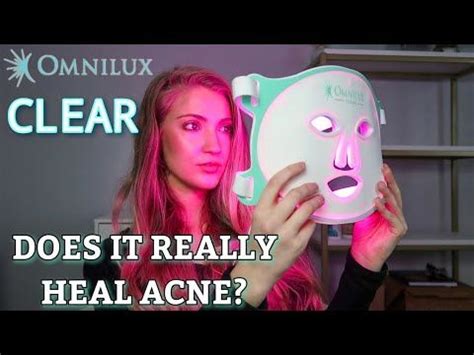 Omnilux Clear LED Face Mask Review (WITH 1 MONTH BEFORE & AFTER RESULTS ...