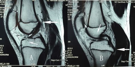 ClinMed International Library | The Original Compared with Terminal in ...