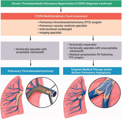 Suggested CTEPH treatment algorithm by the multidisciplinary of our... | Download Scientific Diagram