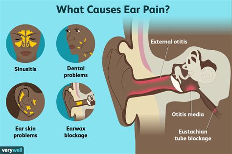 What Your Ear Pain Means and What You Should Do About It (2022)