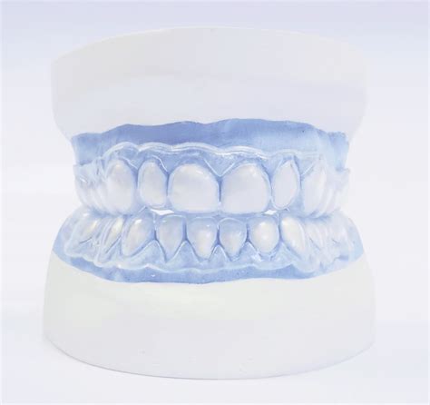 Teeth Whitening / Bleaching Dental Trays (with reservoirs)