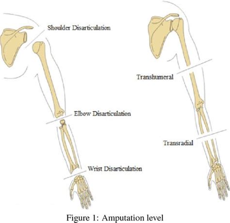 Overview: Mechanism and Control of a Prosthetic Arm. | Semantic Scholar ...