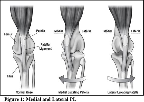 Table 1 from Systematic review of patellar luxation in dogs | Semantic Scholar