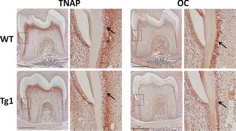 Immunohistochemical analysis of odontoblast markers in WT and... | Download Scientific Diagram