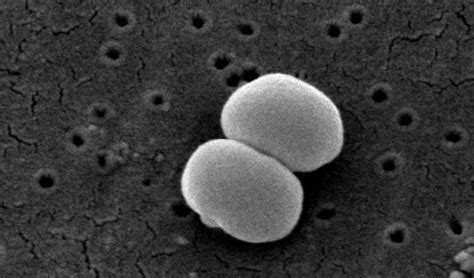 Microbial Diseases of the Skin | Boundless Microbiology