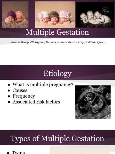 Multiple Gestation PPT | PDF | Multiple Births | Twin