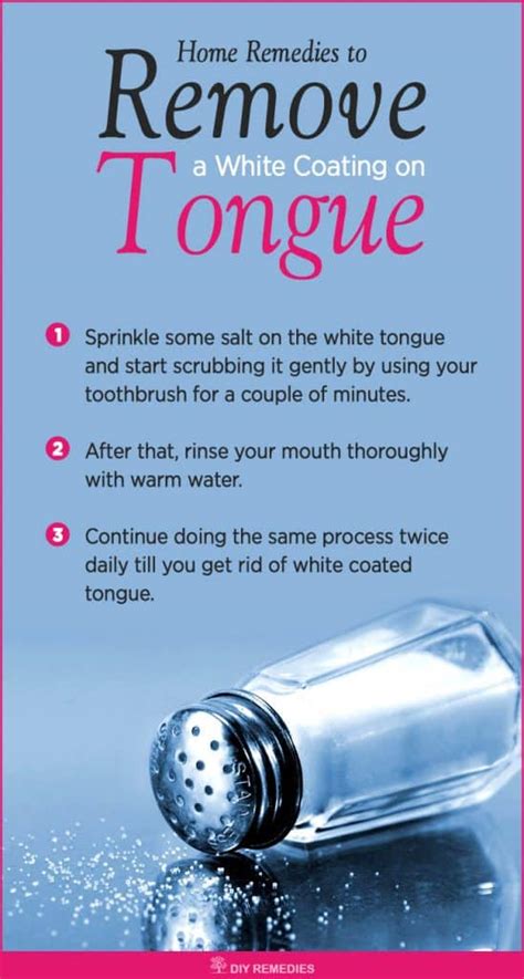 Natural Remedies to Get Rid of a White Coated Tongue