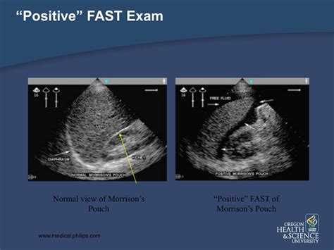 PPT - The Truth about the FAST Exam PowerPoint Presentation, free ...